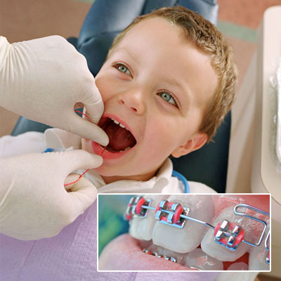 Odontopediatría y Ortodoncia